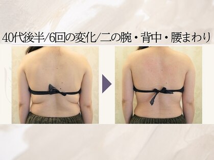 ビーホープ(B.hope)の写真
