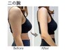 痩身NO.5【痩せにくい二の腕/華奢腕/背中】脂肪分解痩身60分34000円⇒17980円