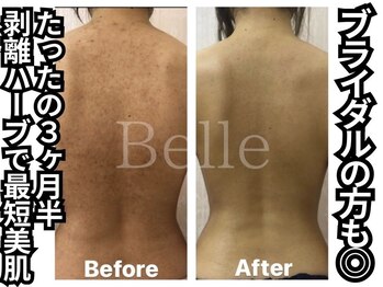 ベル 心斎橋店(Belle)/ブライダルも◎3カ月半の結果