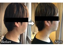 トランザット 六本木店(TransATT)/フェイスラインが整い顔が好印象