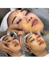 スア(SUA)/かぼちゃピーリング施術風景