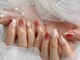 ティンク センター南 アイラッシュアンドネイル (Tink eyelash＆nail)の写真/巻き爪/深爪/チビ爪/反り爪/貝爪など爪の形にコンプレックスがある方、ネイルの持ちが悪い方に◎