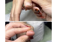 手、爪周りの乾燥が気になる方におすすめ☆