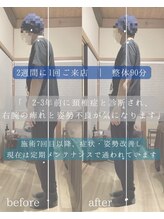 ソウェル(soweru.)/before / after