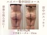 【効果No.1★全身セル脂肪撲滅】サイズダウン率97%☆贅肉の断捨離/全身120分