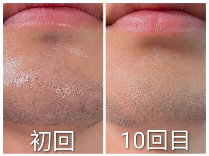 フォーティーワン(FORTY-ONE)の写真