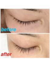 アルセア(ALTHAEA)/Lashaddictサロンケア