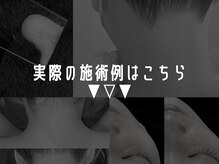 ルーナジェーナ(Luna llena)/池袋　エステ　ルーナジェーナ