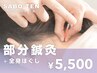 【部分鍼灸＋全身ほぐし】気になる部分を血行促進★30～45分（初回75分）