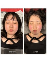 プライミー(PRIMY)/脱・丸顔！シャープな顎