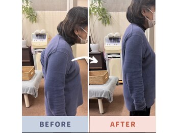 くすの木 治療院/猫背、ぽっこりお腹