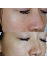 ザ シー タイムレスビューティ(THE SHE)/30代お客様症例写真