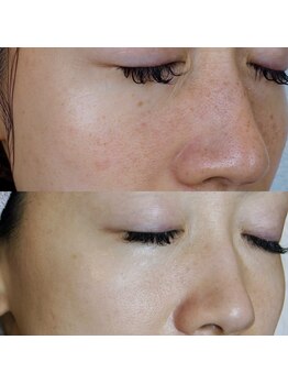 ザ シー タイムレスビューティ(THE SHE)/30代お客様症例写真