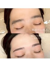 リリフリー(riri Free)/