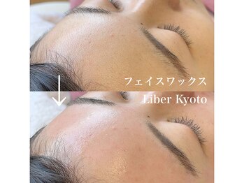 リベルキョウト 京都駅前店(Liber Kyoto)/フェイスワックス脱毛