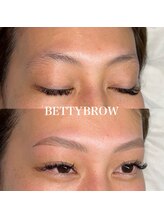 ベティーブロー(Betty Brow)/新ハリウッドブロウリフト