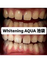 アクア 池袋店(AQUA)/ホワイトニング/池袋/東京/美白