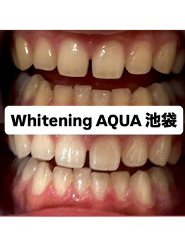 アクア 池袋店(AQUA)/ホワイトニング/池袋/東京/美白