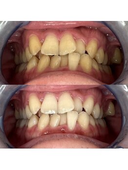 プロテア 藤枝店(PROTEA)/ブライダルメニューあり