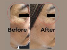 ベルシア(BELXIA)/シミ・シワに強いサロン