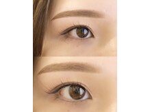 ティンクアイ(Tink eye)