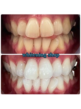 ホワイトニングショップ 倉敷店/