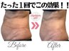 【二の腕、肩こり&ポッコリお腹&痩身】上半身ハイパーナイフ&リンパ60分¥7000
