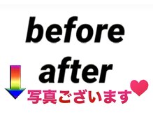 リリーフ(relief)/