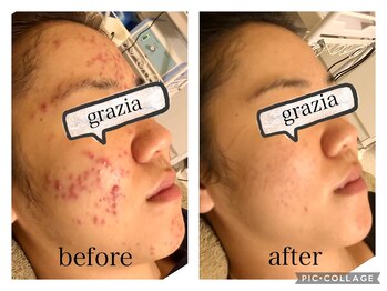トータルビューティーグラッツィア(Total Beauty Grazia)/本気でお肌を改善されたい方必見