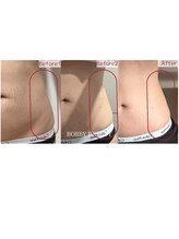 エクリア(ECLIA)/レッドショット3cc×EMS