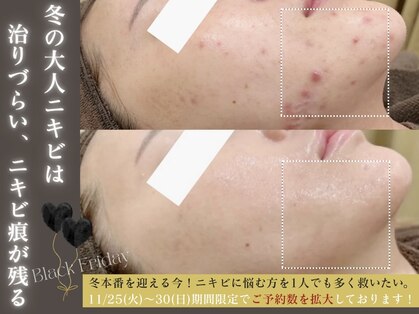 エピア 岡崎店(Epia)の写真