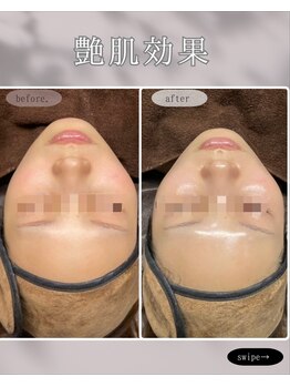 レア 姫路店(le'a)/ラミネーションピール