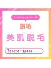 トータルビューティーサロン 凛/脱毛効果の高さに喜びの声