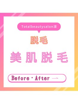 トータルビューティーサロン 凛/脱毛効果の高さに喜びの声