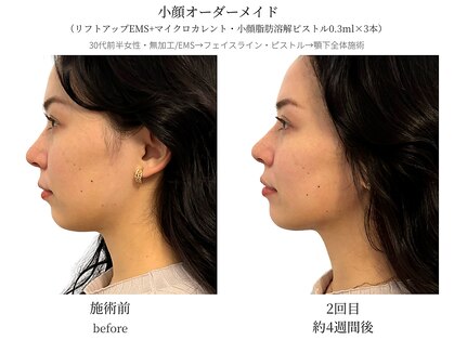 サボラミ(sabor A Mi)の写真