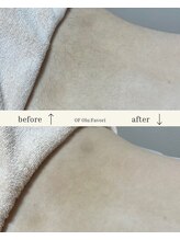 オフオルファヴォリ(OF Olu:Favori)/【フラッシュワックス脱毛】