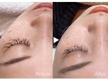 アリエルリッチ/【美肌ケア】Before左→After右