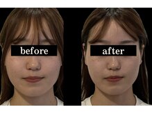 ソナ 大和西大寺院(SONA)/