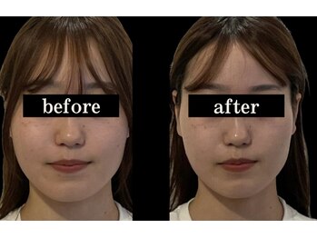 ソナ 大和西大寺院(SONA)/