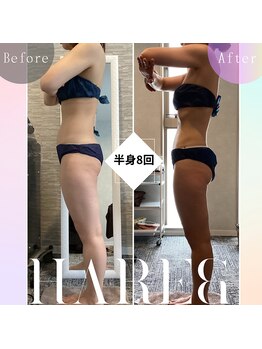 ハレアンド(Hare&)/30代後半半身痩身8回目