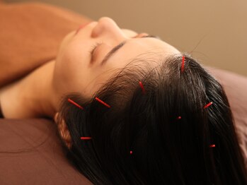 ハリラックス(HA:Ri/LAX)/【美容鍼灸の様子】