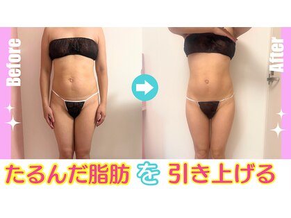 リラ(Lilas)の写真