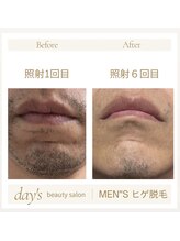 デイズ(day’s)/毎日の面倒な自己処理卒業！