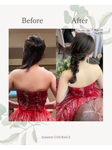 アーマンクラージュ(Ahmen Courage)/ブライダルエステ【赤羽/痩身】