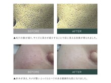 ナチュリー(Naturry)/症例数多数あり！