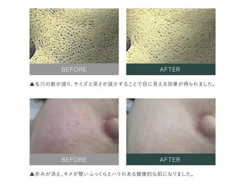 ナチュリー(Naturry)/症例数多数あり!