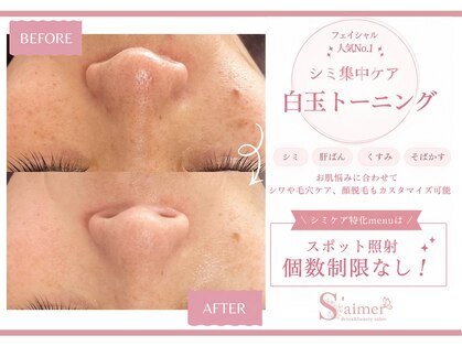 セメ(S'aimer)の写真