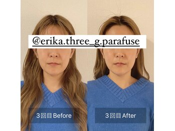 スリージー/before/after