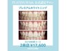 本気の白さへ【プレミアムセルフホワイトニング】40分照射/2回来店　￥9800