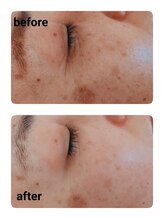 サロンドットブレスドットケイ(salon.bless.k)/施術前後の変化